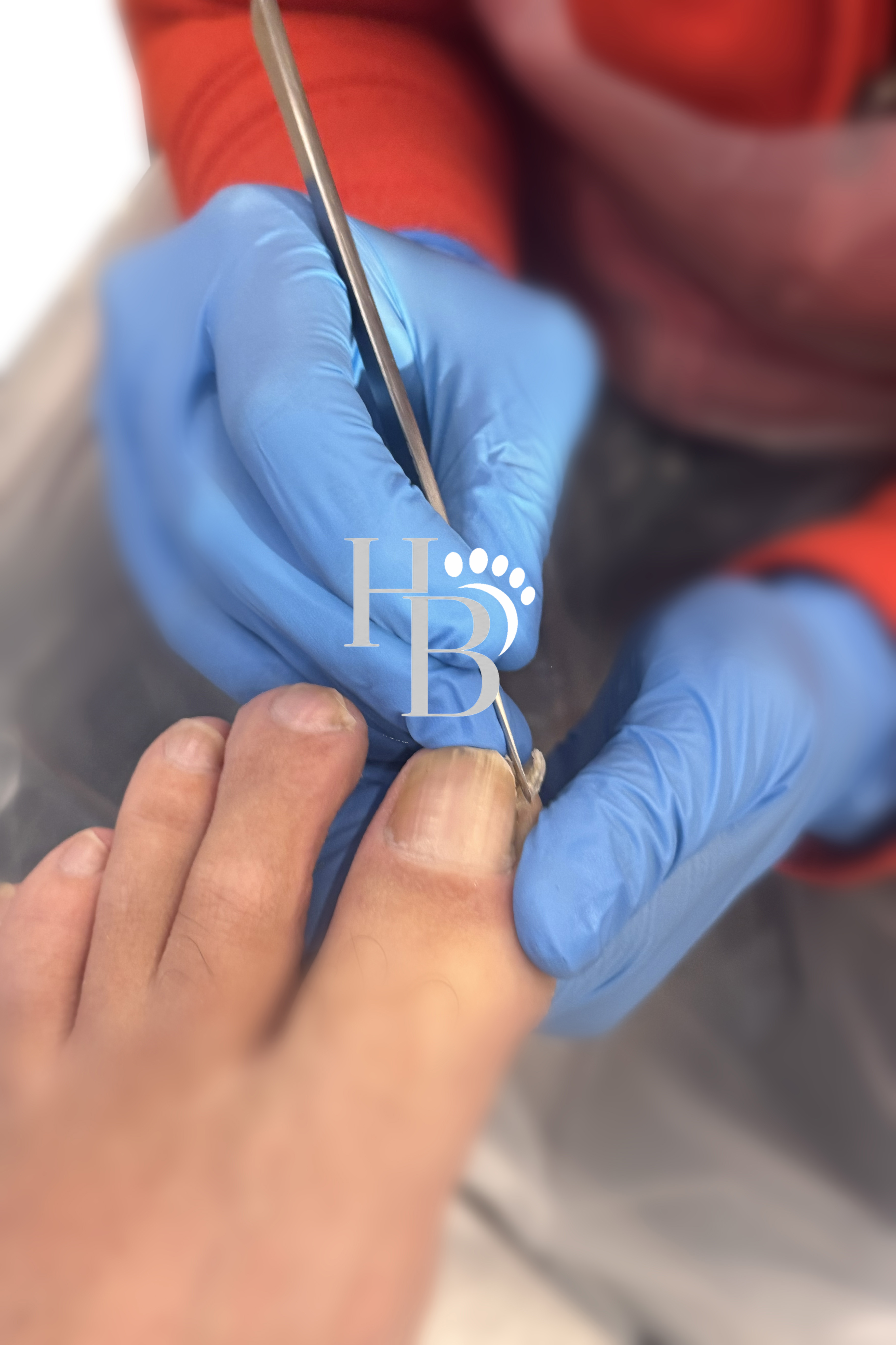 Speciális lábápolás galériakép 4